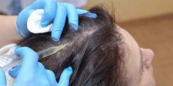 As hair thinning, recession, and balding affects millions of men and women worldwide, it’s no wonder there are always new treatment methods coming onto the market. One such method is […]