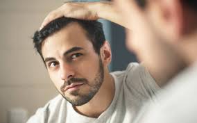 Perhaps you recall the day you realized you might be losing your hair. It may have been while brushing your teeth that you noticed a loss of hair around your […]