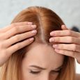 Although hair loss may seem like a more prominent problem in men, women are nearly as likely to lose, or have, thinning hair. Most women notice it in their 50s […]