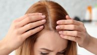 Although hair loss may seem like a more prominent problem in men, women are nearly as likely to lose, or have, thinning hair. Most women notice it in their 50s […]