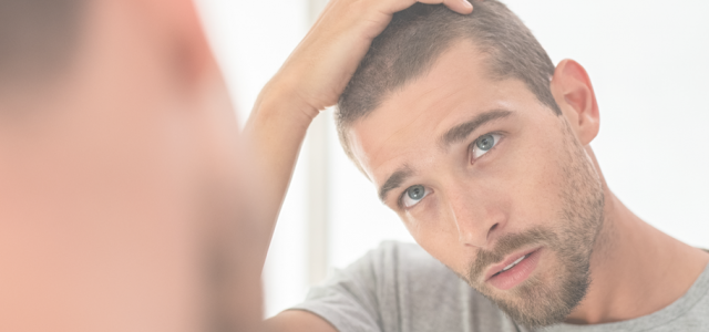 La Mesa Medical Hair Restoration has a reputation for repairing previous clinics’ bad work. The severity of such cases, and their solutions, range a great amount. What is certain, however, […]